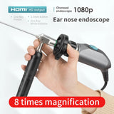 ENT Endoscope 110mm2.7mm/4.0mm30 Degree Ultra-High Definition 21 Inch 1080P Cold Light Source Wireless Adjustable Zoom Endoscope