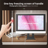 10.1 inch Display IPS Screen Endoscope Prices 3.9mm Digital Usb Ear Inspection Visual Otoscope set