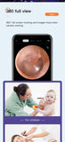 Digital Hd Earwax Removal 3.9mm Otoscope Camera Otoscopio Con Camara For Ios camera endoscope